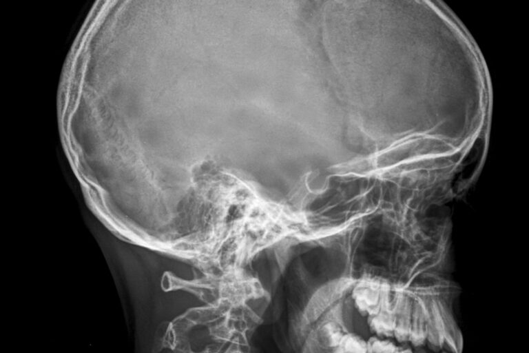 ESTUDIAR NEUROEDUCACION EN MÉXICO